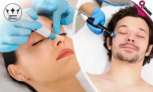 Premium HydraFacial Session for Ladies & Men!